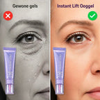 Gewone gels versus Instant Lift Ooggel