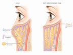 radiant-lf-nl-advert_3_mechanism.webp