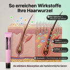 Rosemary PDRN Spicule Kopfhaut-Serum™ – Bio-Microneedling Haarwuchs-Behandlung